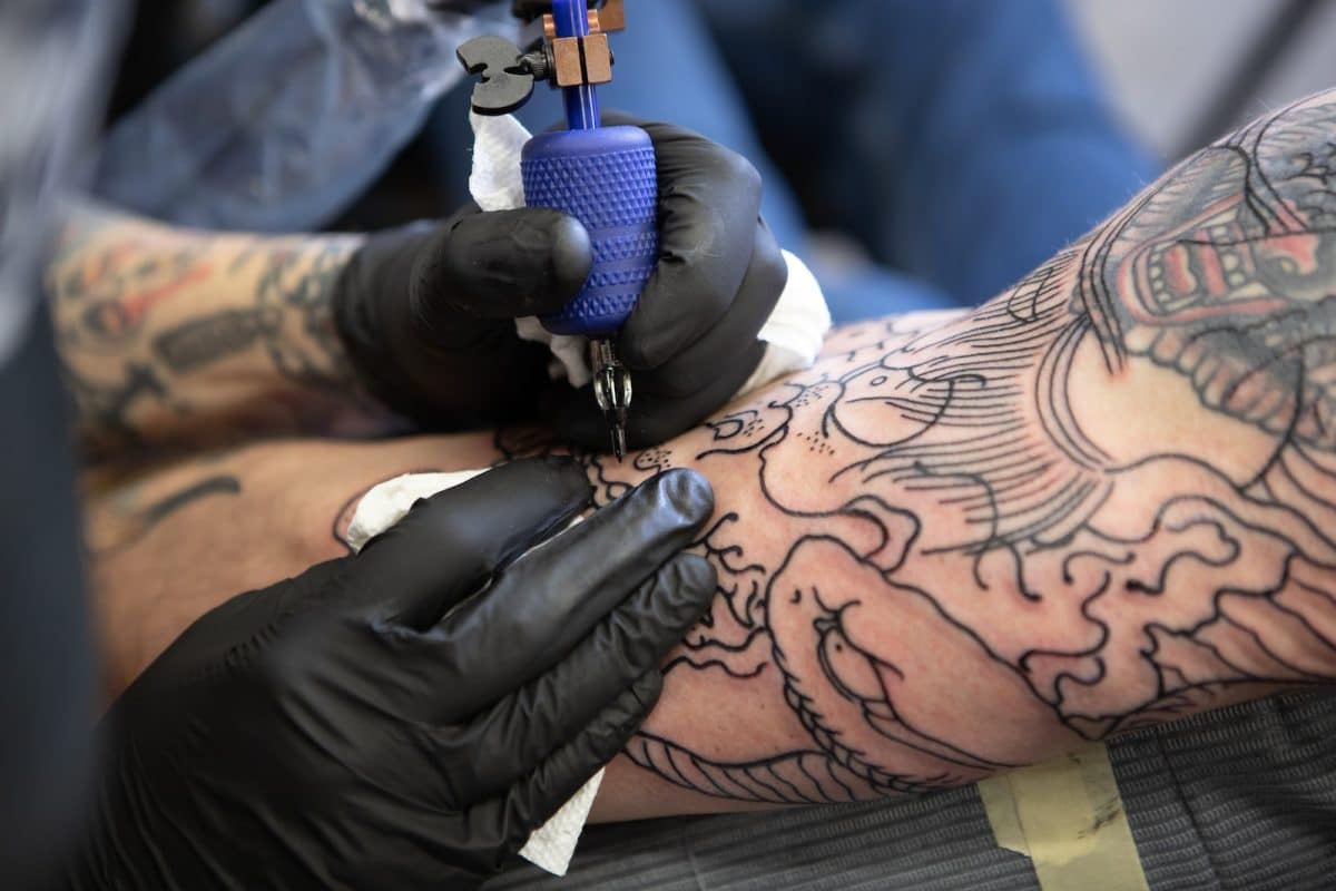 Enlèvement des tatouages, ce que vous devez savoir
